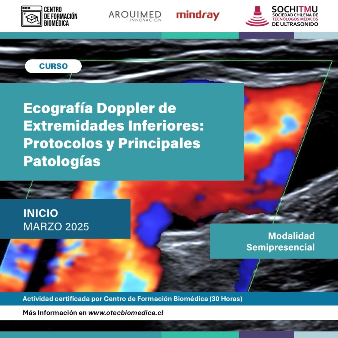 [Semipresencial] Ecografía Doppler de Extremidades Inferiores: Protocolos y Principales Patologías