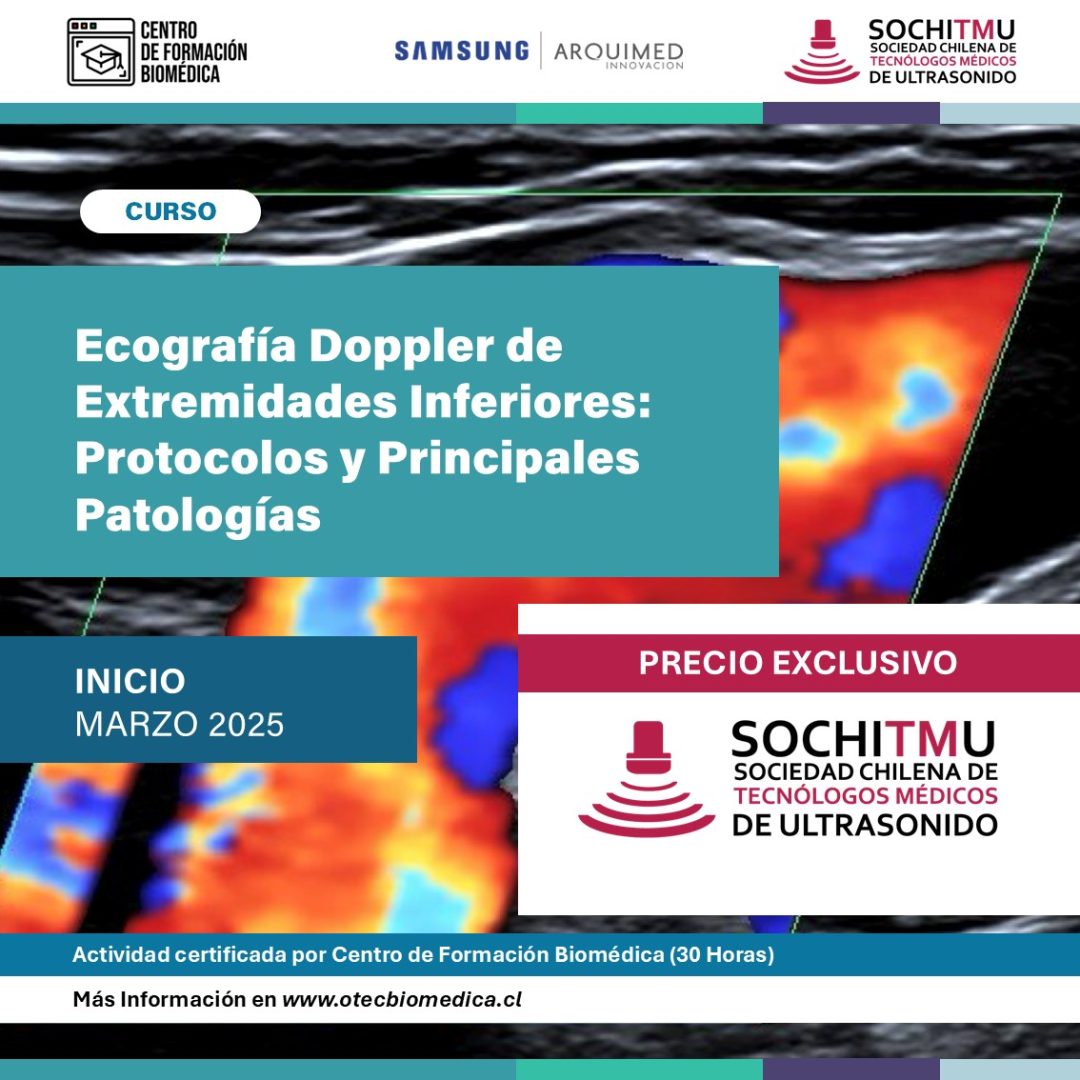 [Solo Online] Ecografía Doppler de Extremidades Inferiores: Protocolos y Principales Patologías