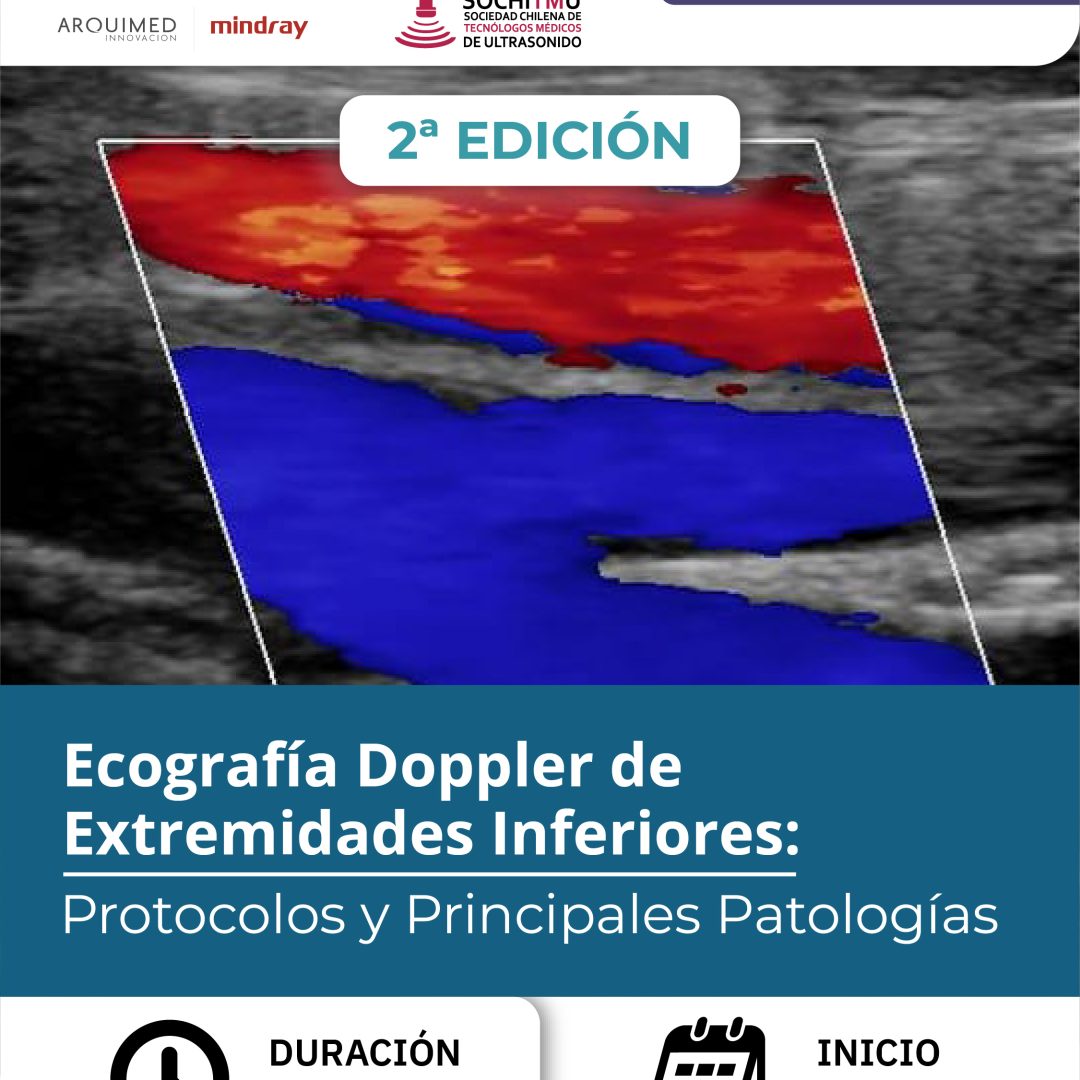 [Online/SOCHITMU/COLEGIO] Ecografía Doppler de Extremidades Inferiores: Protocolos y Principales Patologías